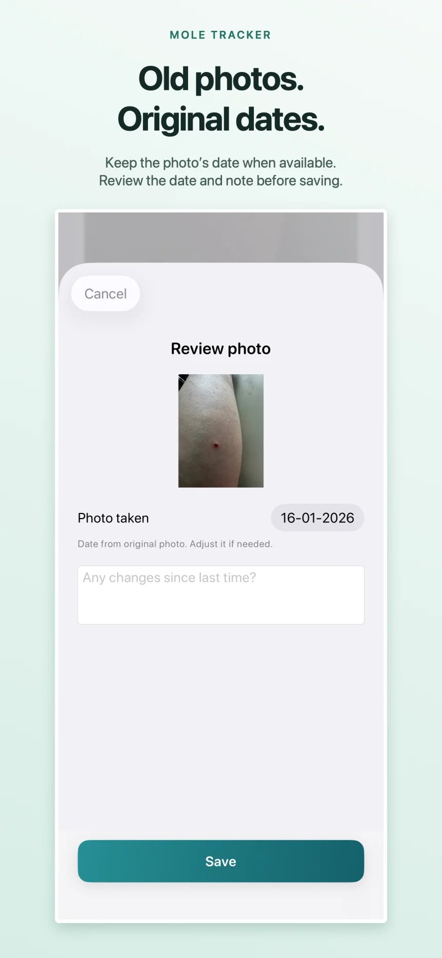 Mole Tracker: Skin Check Diary
